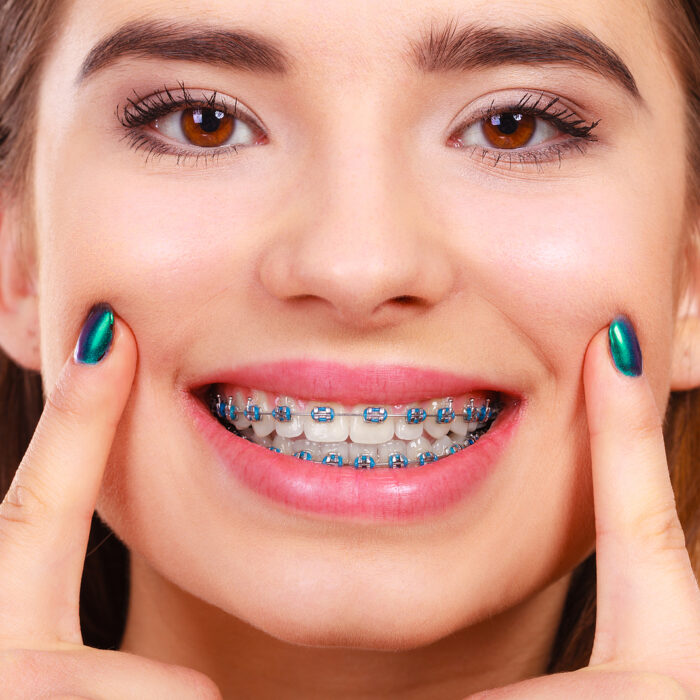 Dental Implant
